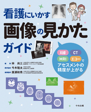 看護にいかす画像の見かたガイド　―Ｘ線・ＣＴ・ＭＲＩ・エコーでアセスメントの精度が上がる