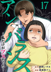 アンバランス～私だけがブスだった～ 17巻